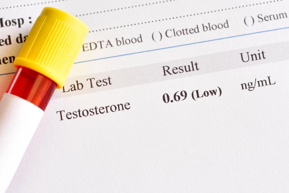 how-to-know-if-you-have-low-testosterone-texas-center-for-urology